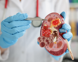 Urology niche Healthcare Digital Marketing | Rankved